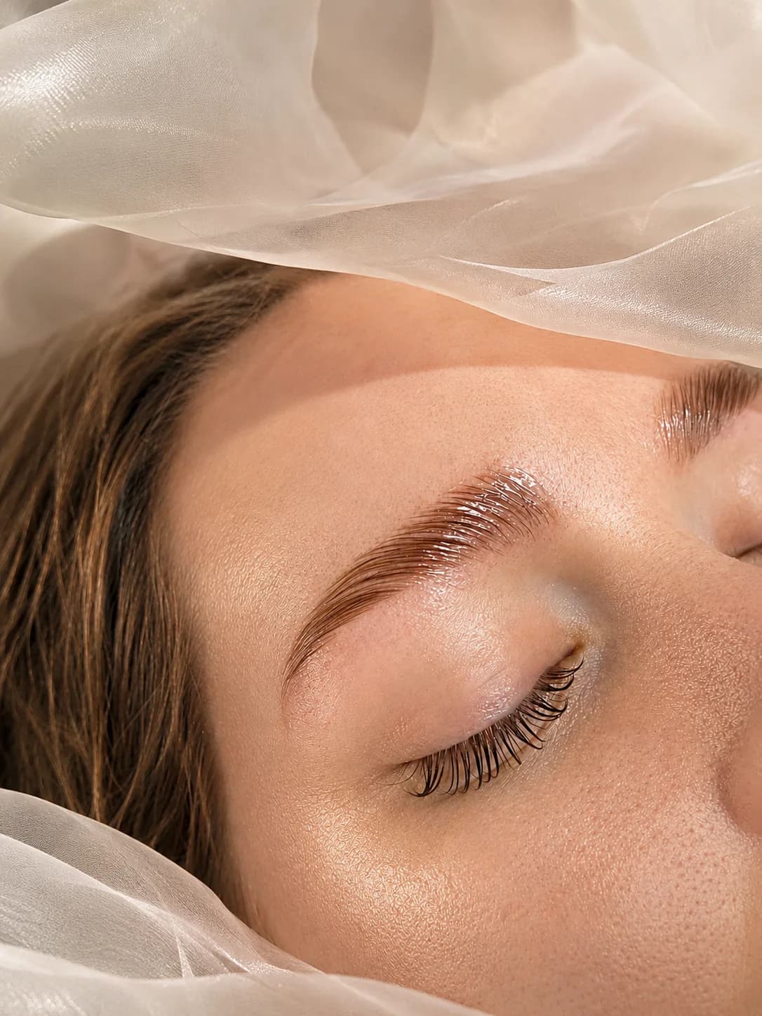 Brow Lifting